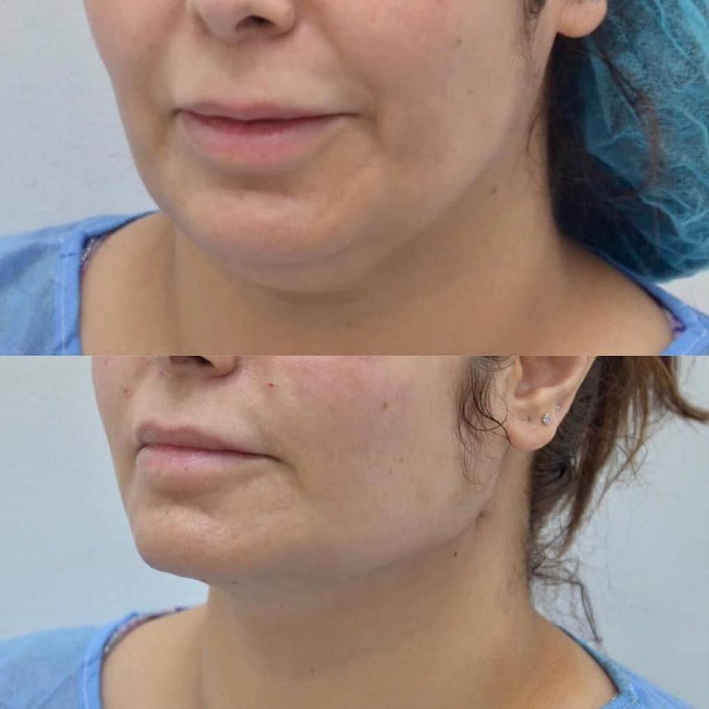 225096680_195433639263798_4167846343393330295_n