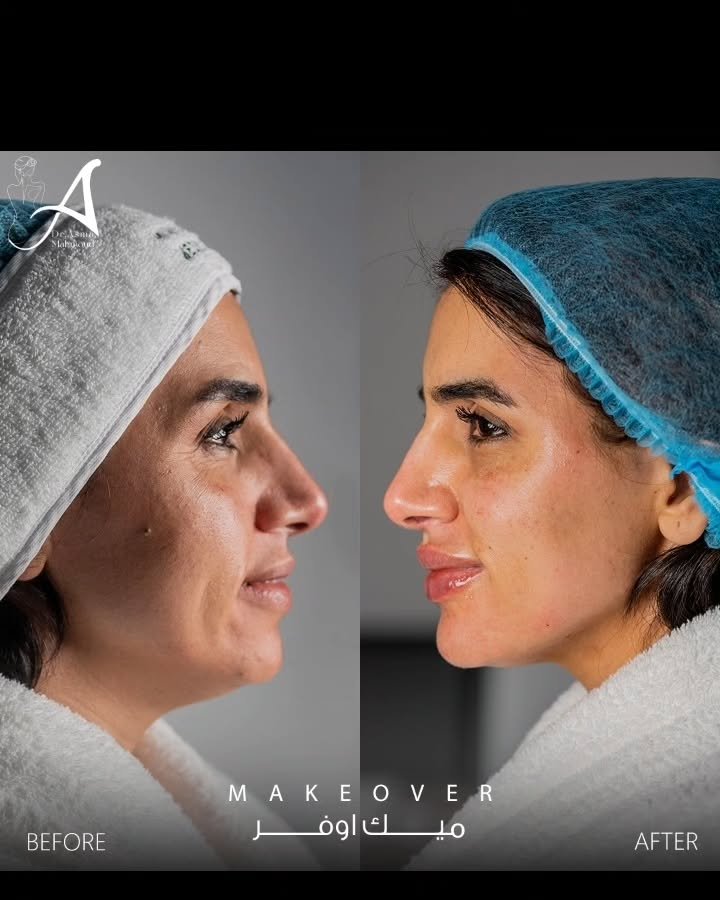 393610244_997171138216178_186663187563311234_n