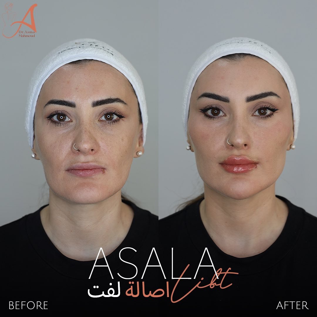 468873710_18060542461854227_827270805992507939_n