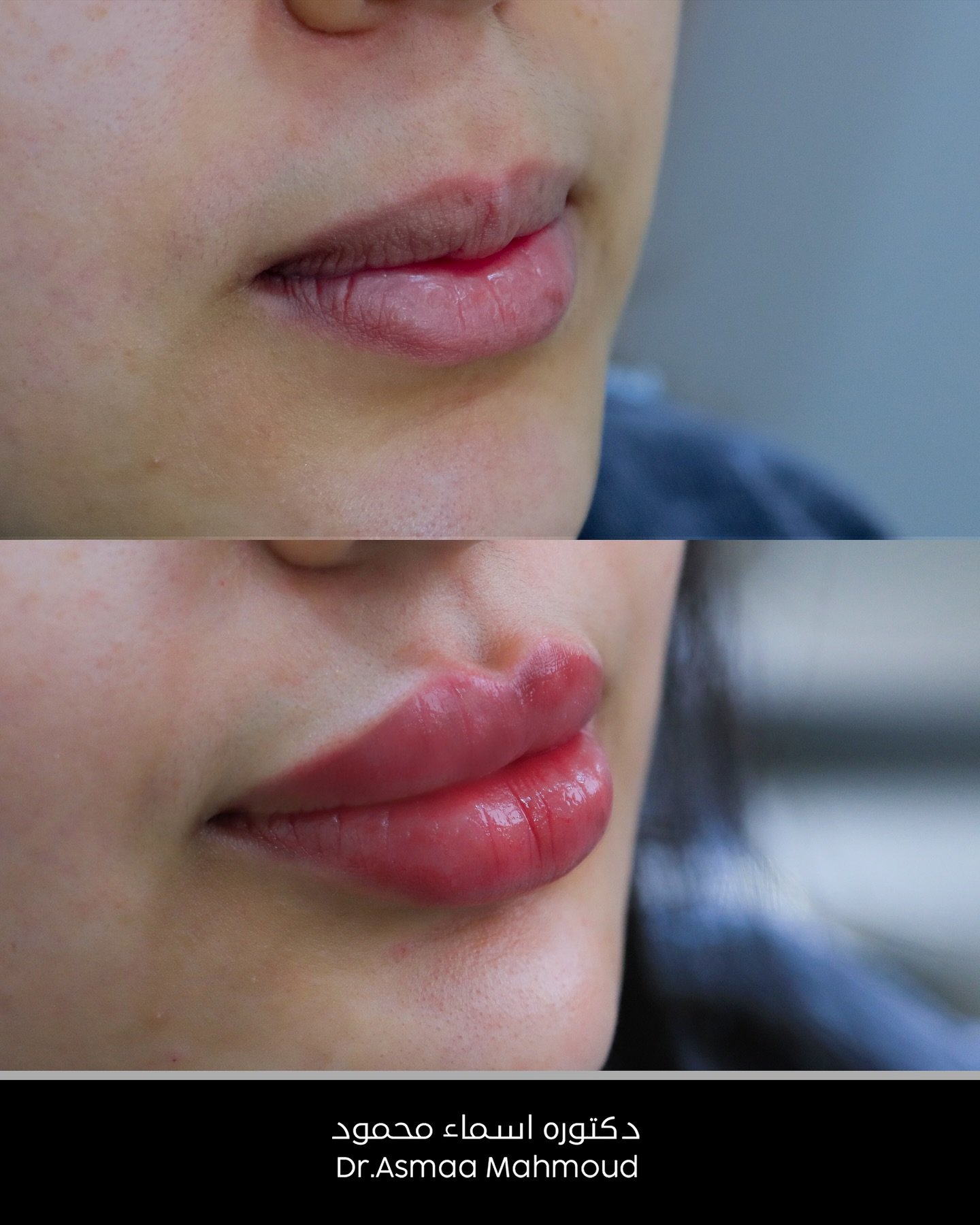 486295795_18071403184854227_6132756367280191641_n