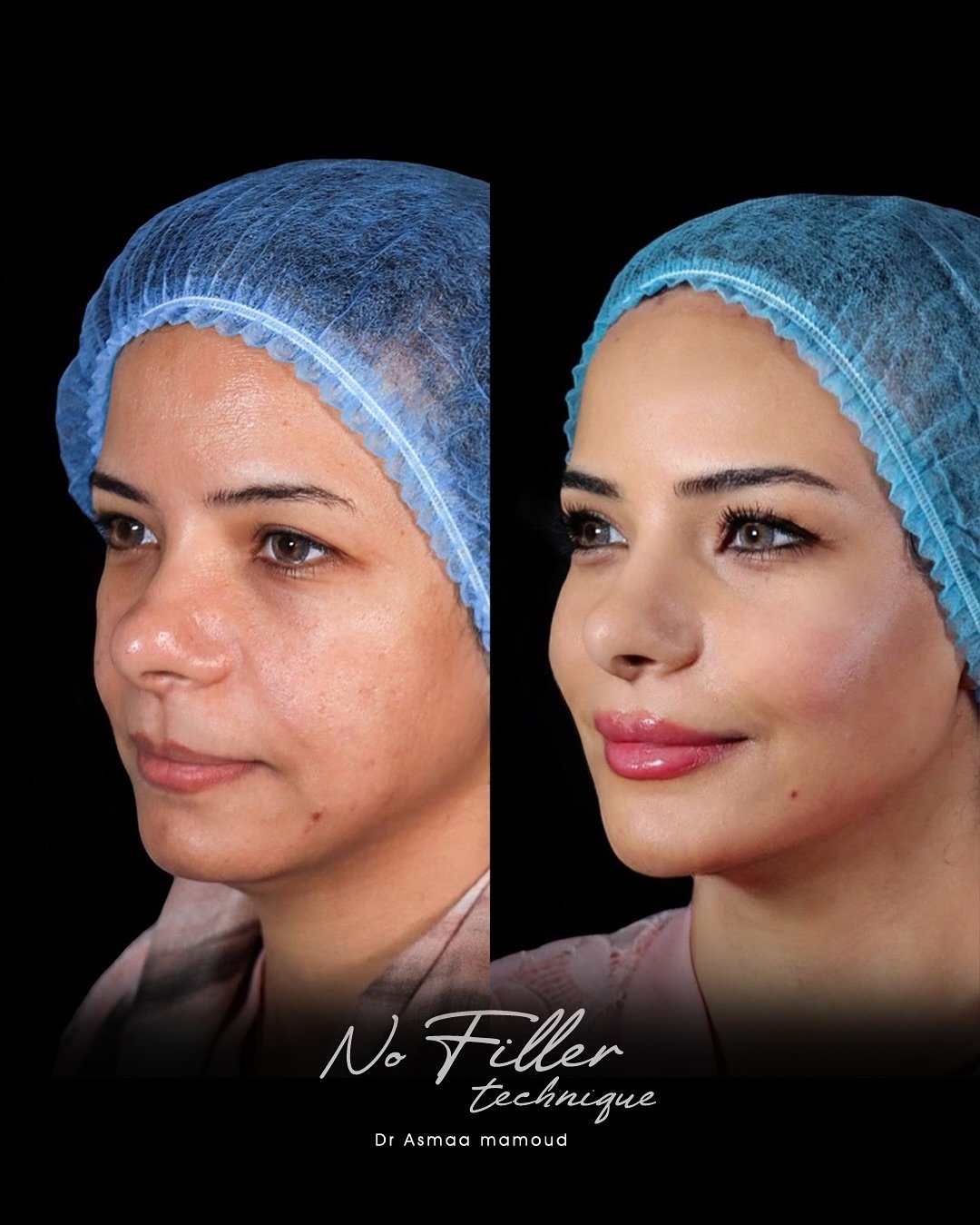 486577147_18071683510854227_7564479847237484528_n