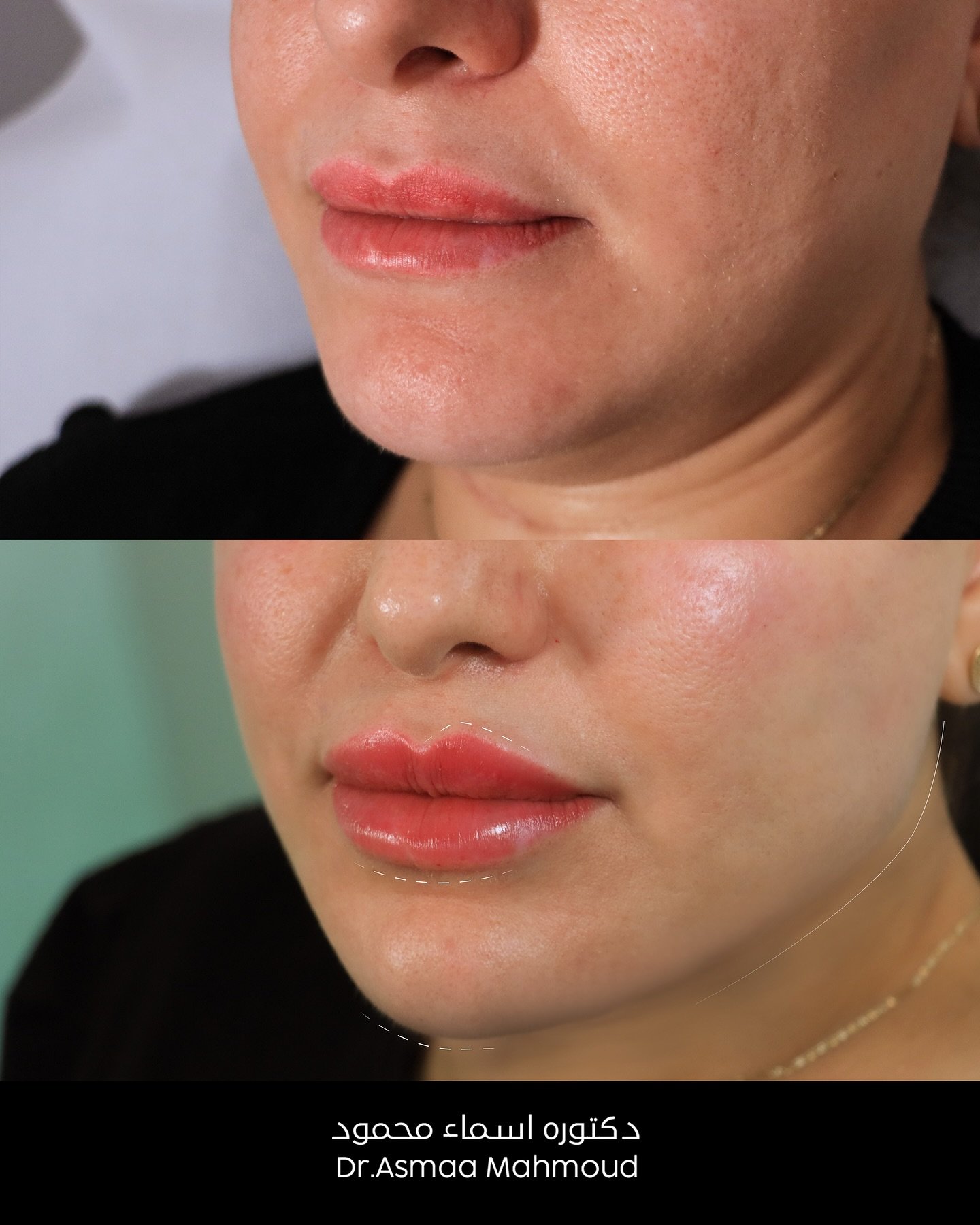 490214482_18072905494854227_4810151515838038530_n