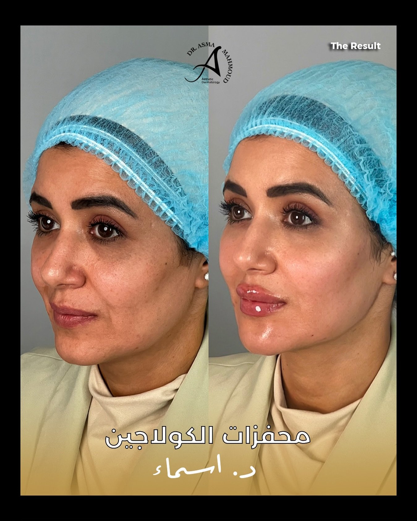 498592039_18076439833854227_5232655764552424812_n